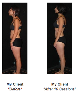 rolfing-before-after