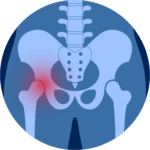 Rolfing with Rob mcWilliams in Boulder Co helps hip pain