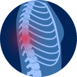 Rolfing with Rob mcWilliams in Boulder Co helps back pain