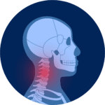 Rolfing with Rob mcWilliams in Boulder Co helps with neck pain